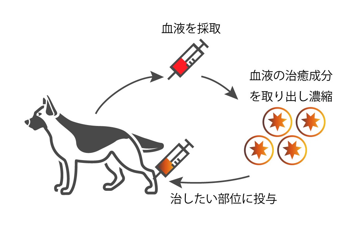 PRPとは