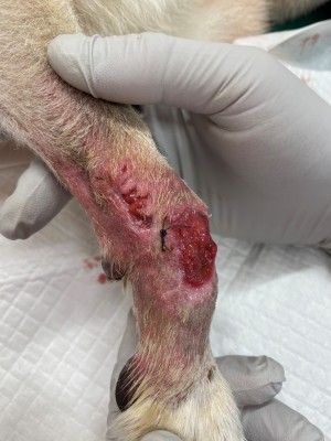 足先の腫瘍の手術８