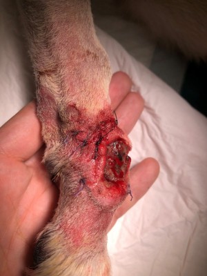 足先の腫瘍の手術6