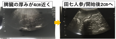 漢方2